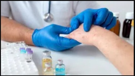 Bệnh đậu mùa khỉ và những điều bạn cần biết